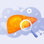 تصویر علمی و آموزشی از کبد چرب با تجمع چربی در سلول‌های کبدی، نشان‌دهنده اثر ریزمغذی‌ها و سبک زندگی بر سلامت کبد